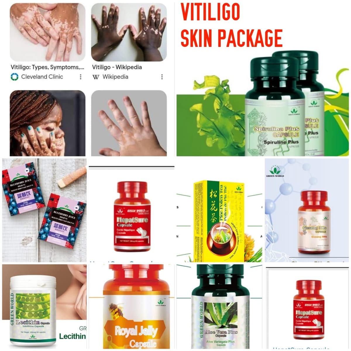 Vitiligo package